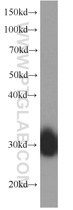 WB analysis of human plasma using 66215-1-Ig