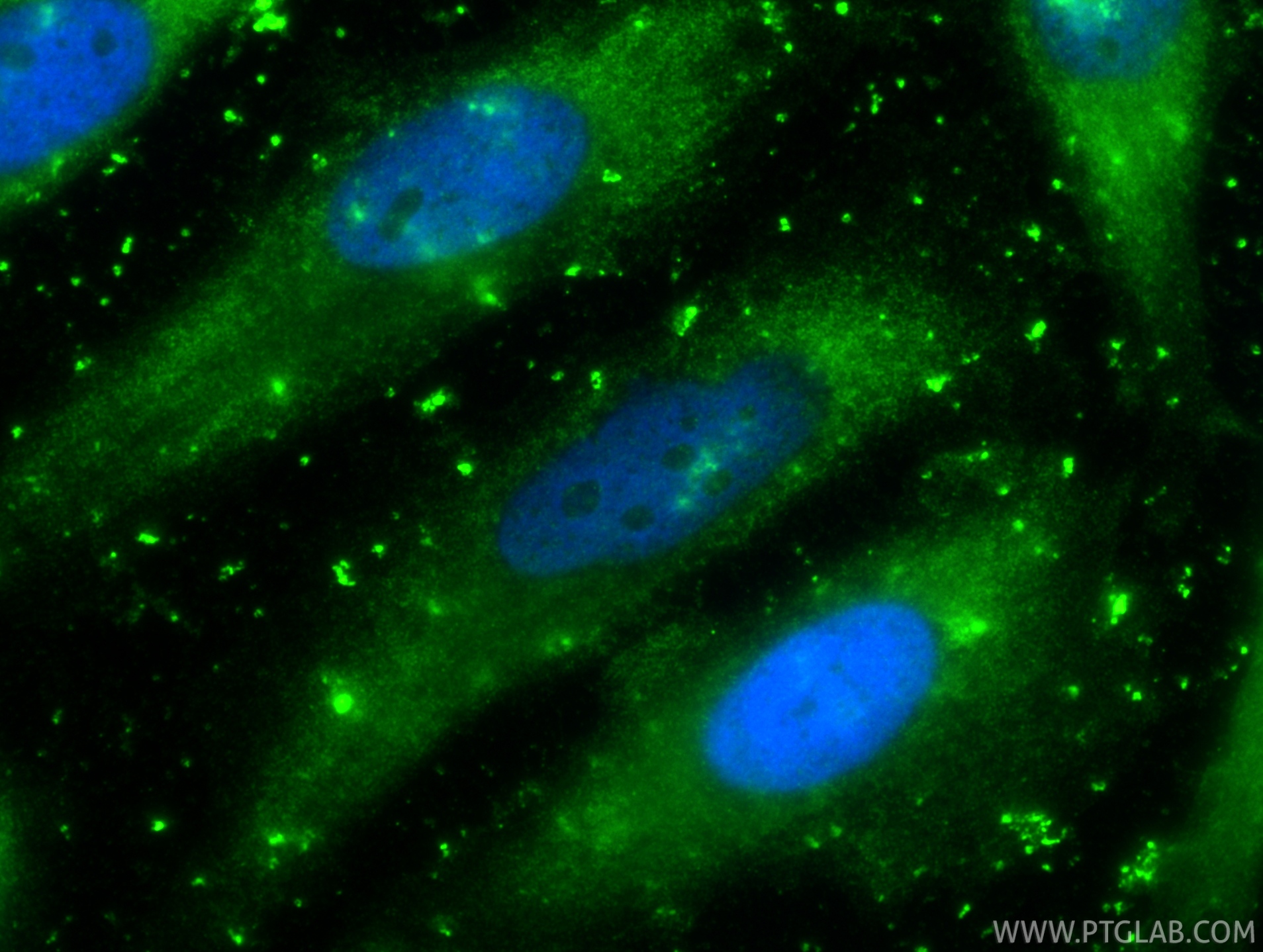 IF Staining of HeLa using 86500-2-RR IF Staining of HeLa using 86500-2-RR