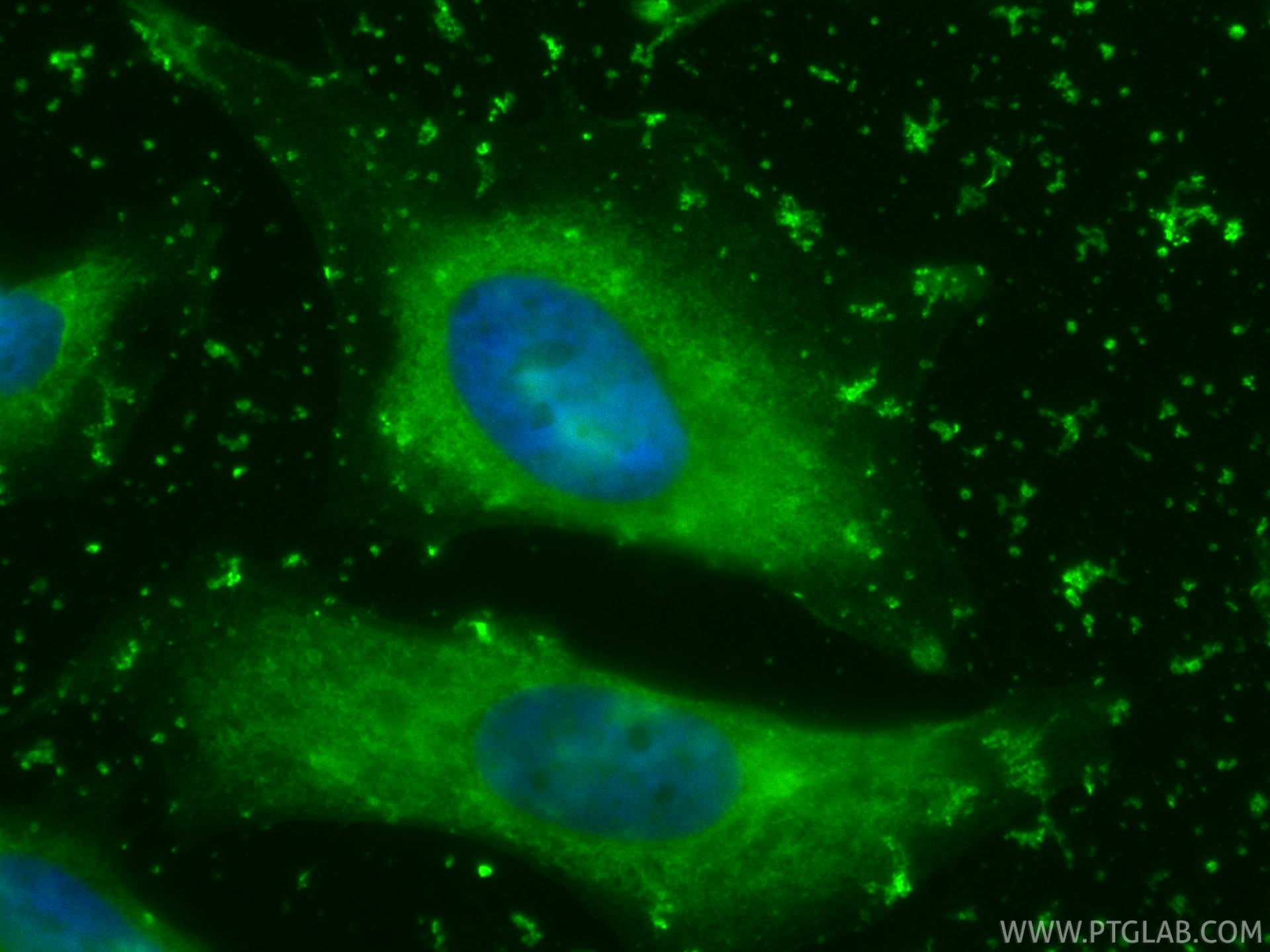 IF Staining of HeLa using CL488-86500-2 IF Staining of HeLa using CL488-86500-2