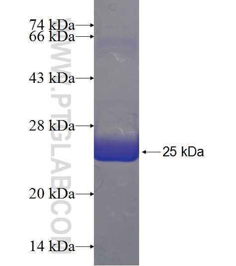 APOD fusion protein Ag21422 SDS-PAGE