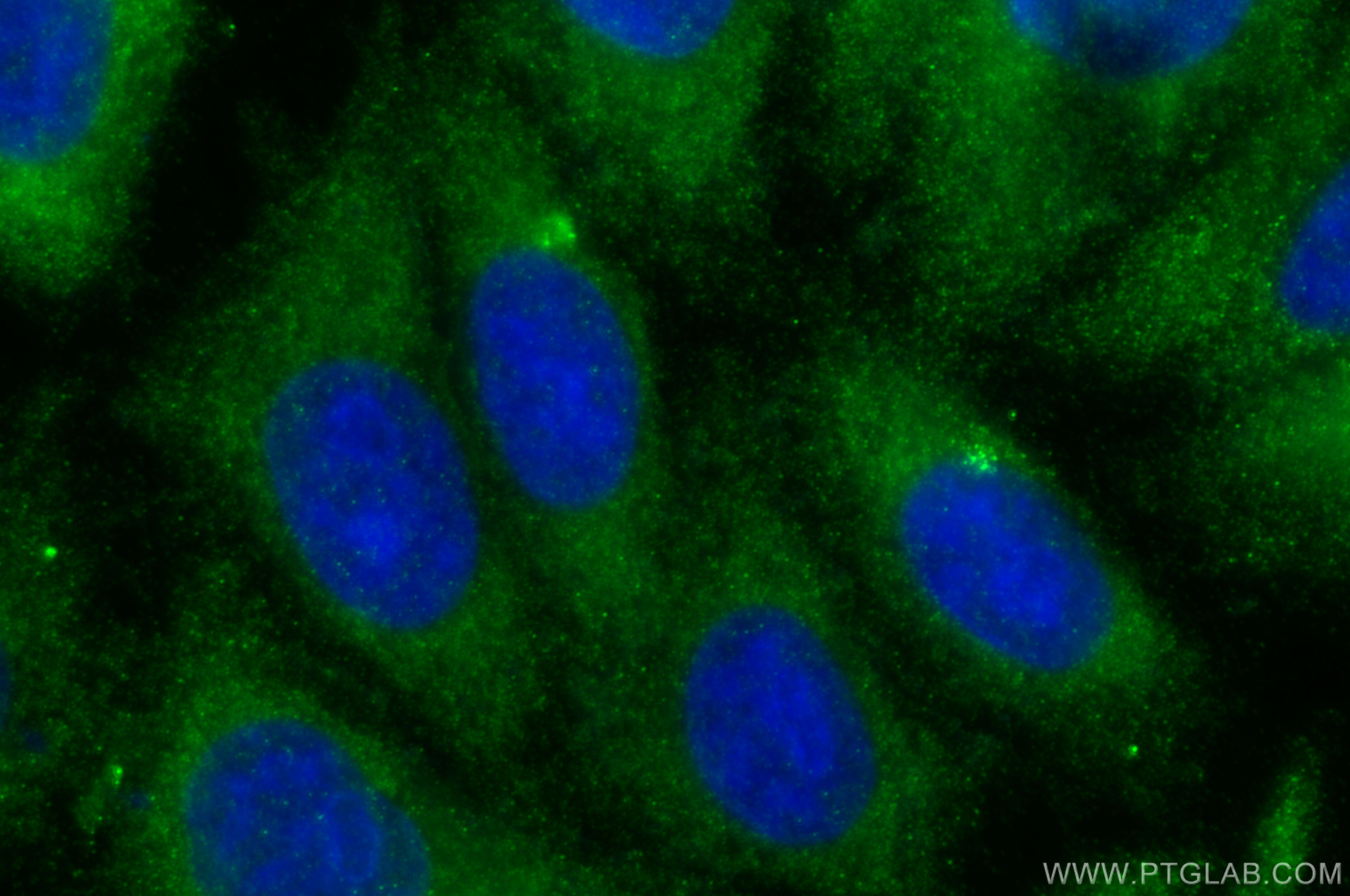 IF Staining of HepG2 using 18254-1-AP