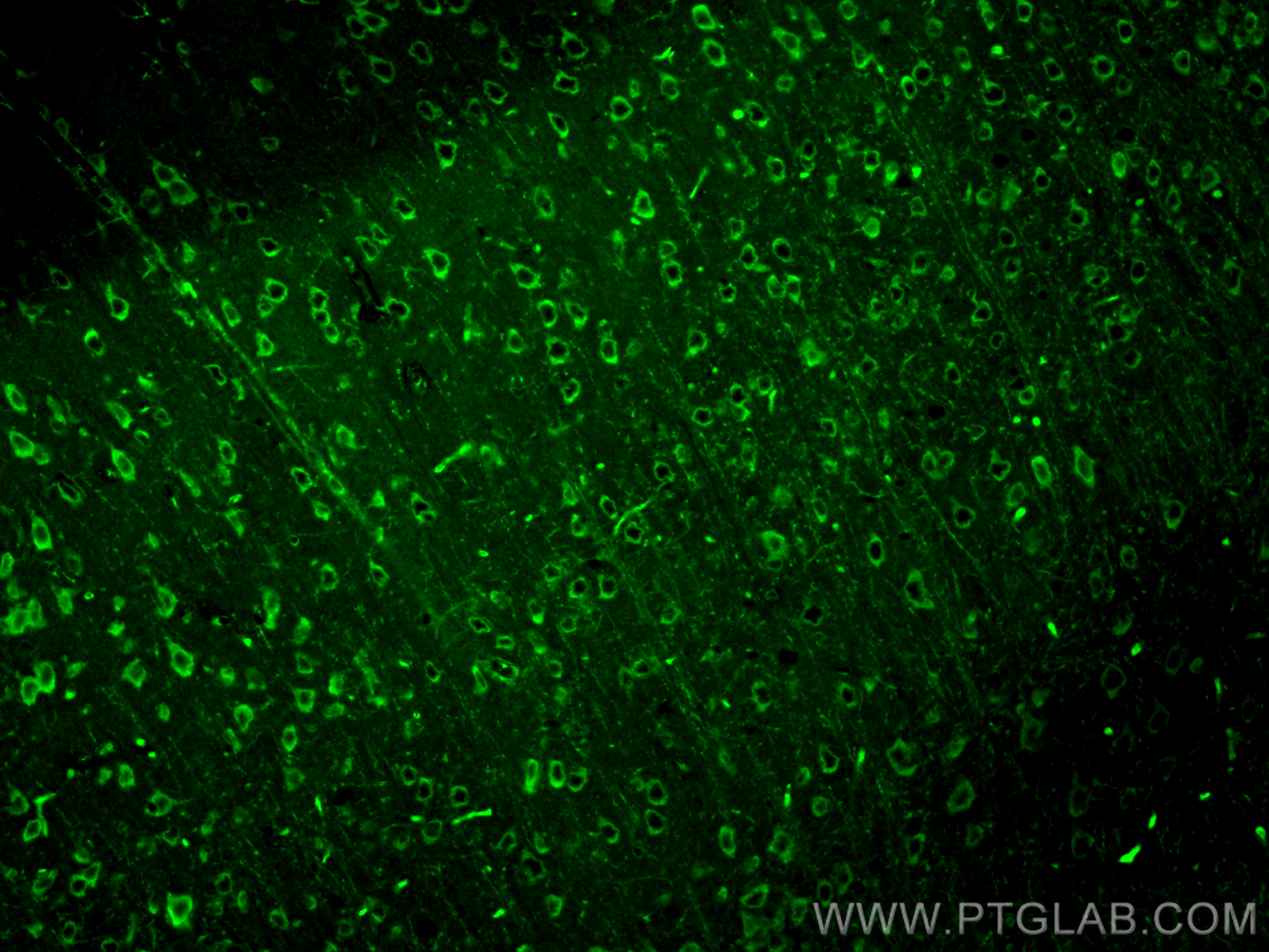 IF Staining of mouse brain using 30535-1-AP