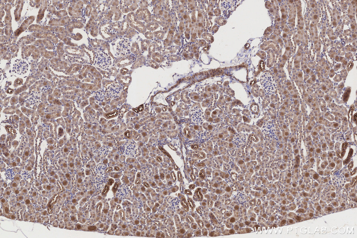 Immunohistochemical analysis of paraffin-embedded mouse kidney tissue slide using 66830-1-Ig (APOE antibody) at dilution of 1:1000 (under 10x lens). Heat mediated antigen retrieval with Tris-EDTA buffer (pH 9.0). IHC staining of mouse kidney using 66830-1-Ig