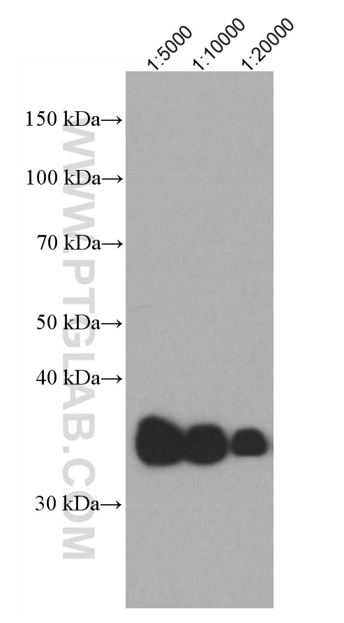 WB analysis of human plasma using 66830-1-Ig (same clone as 66830-1-PBS)
