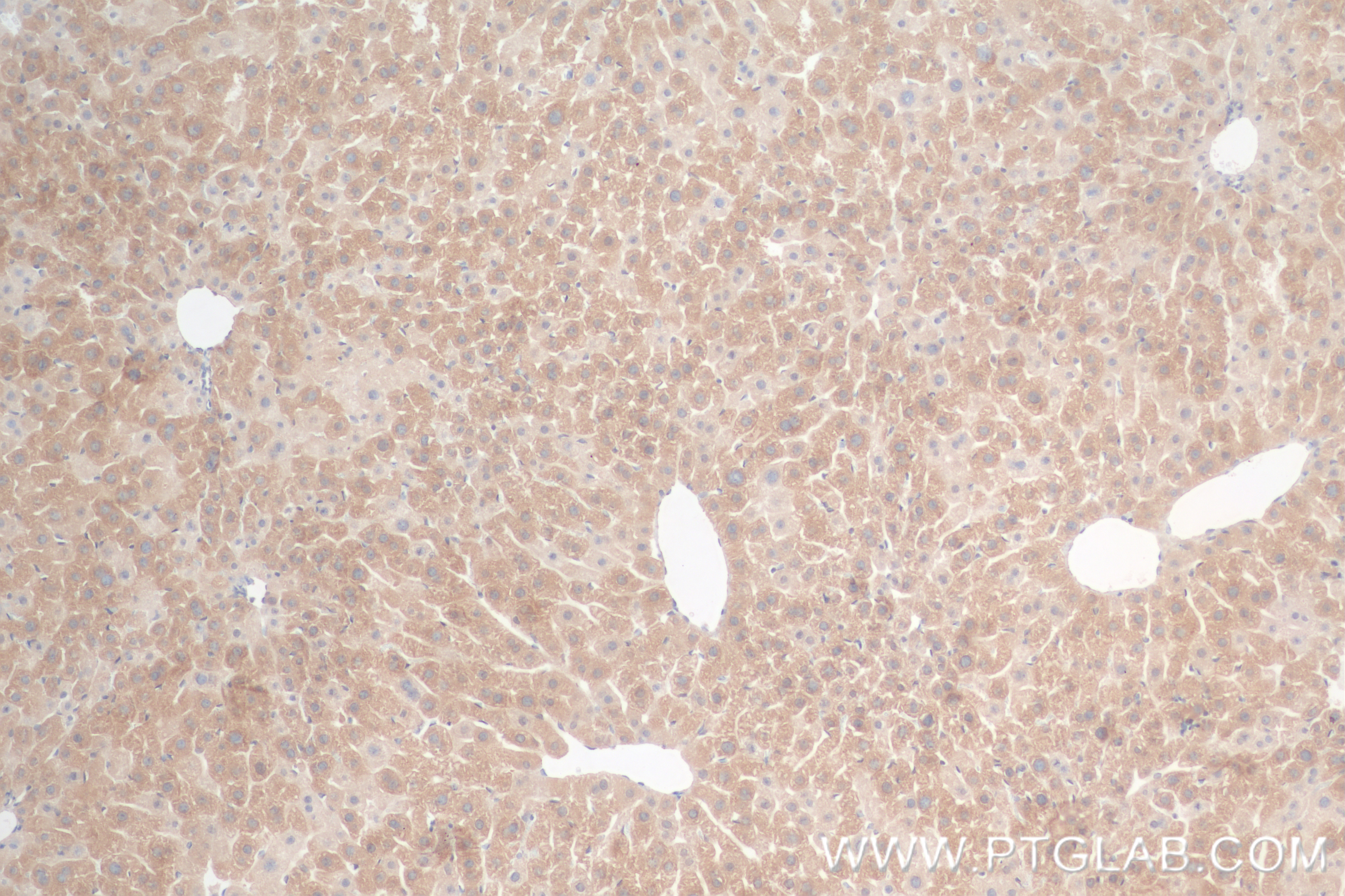 IHC staining of mouse liver using 84775-7-RR (same clone as 84775-7-PBS)