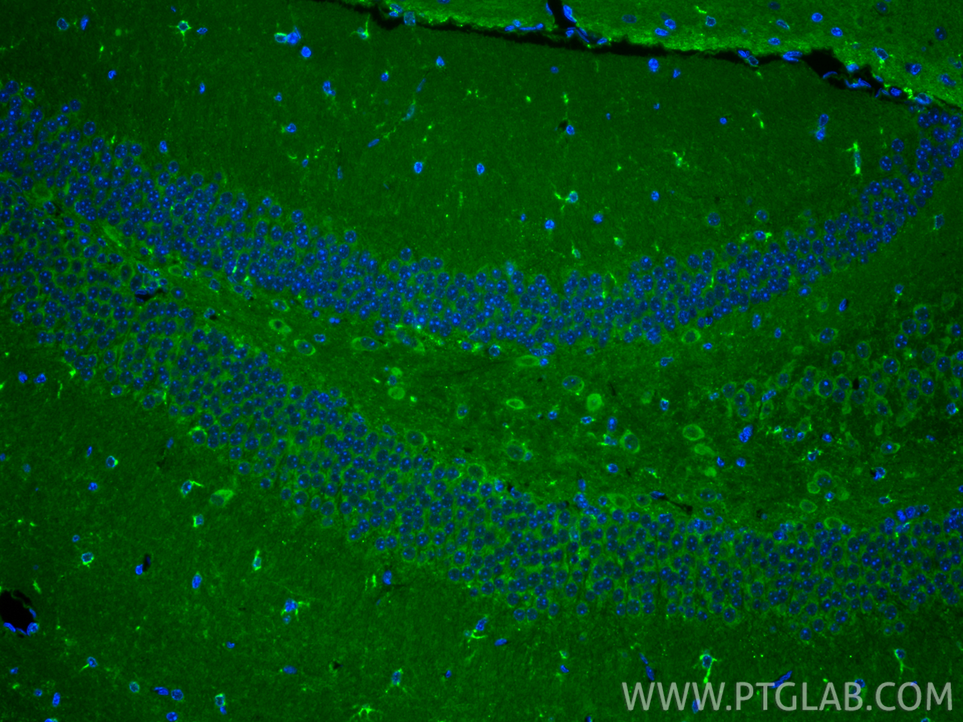 IF Staining of mouse brain using CL488-31454 IF Staining of mouse brain using CL488-31454