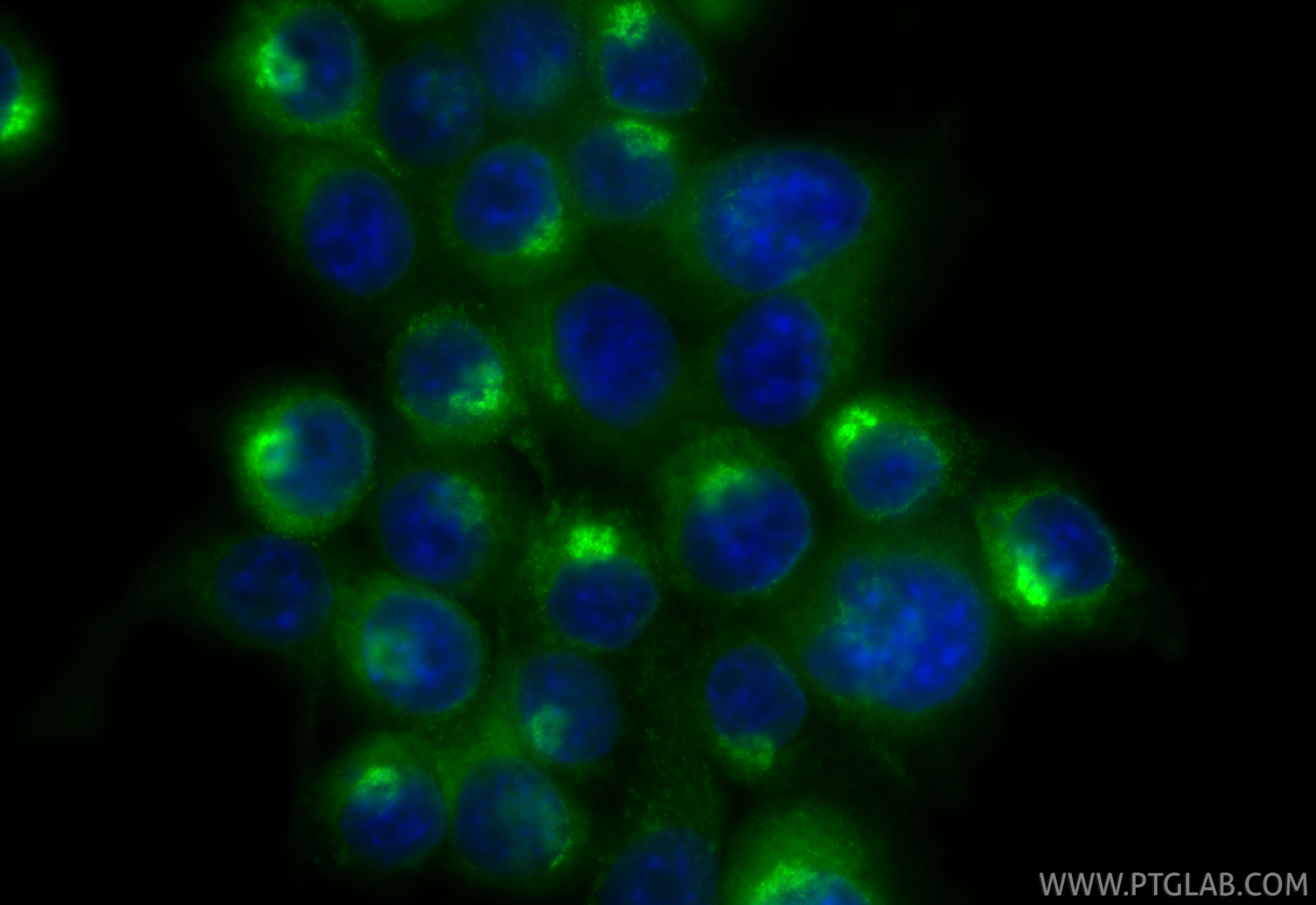 IF Staining of BV-2 using CL488-31454 IF Staining of BV-2 using CL488-31454