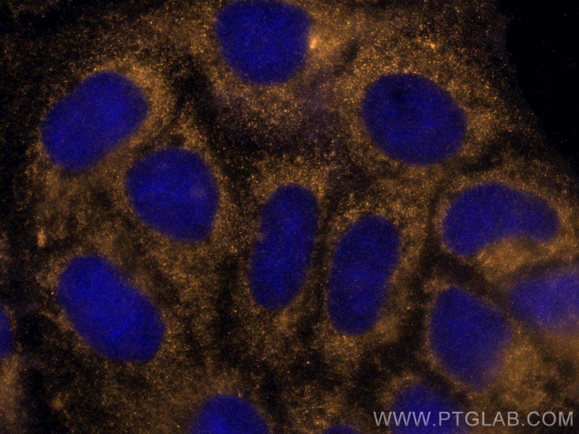 IF Staining of Caco-2 using CL555-66830