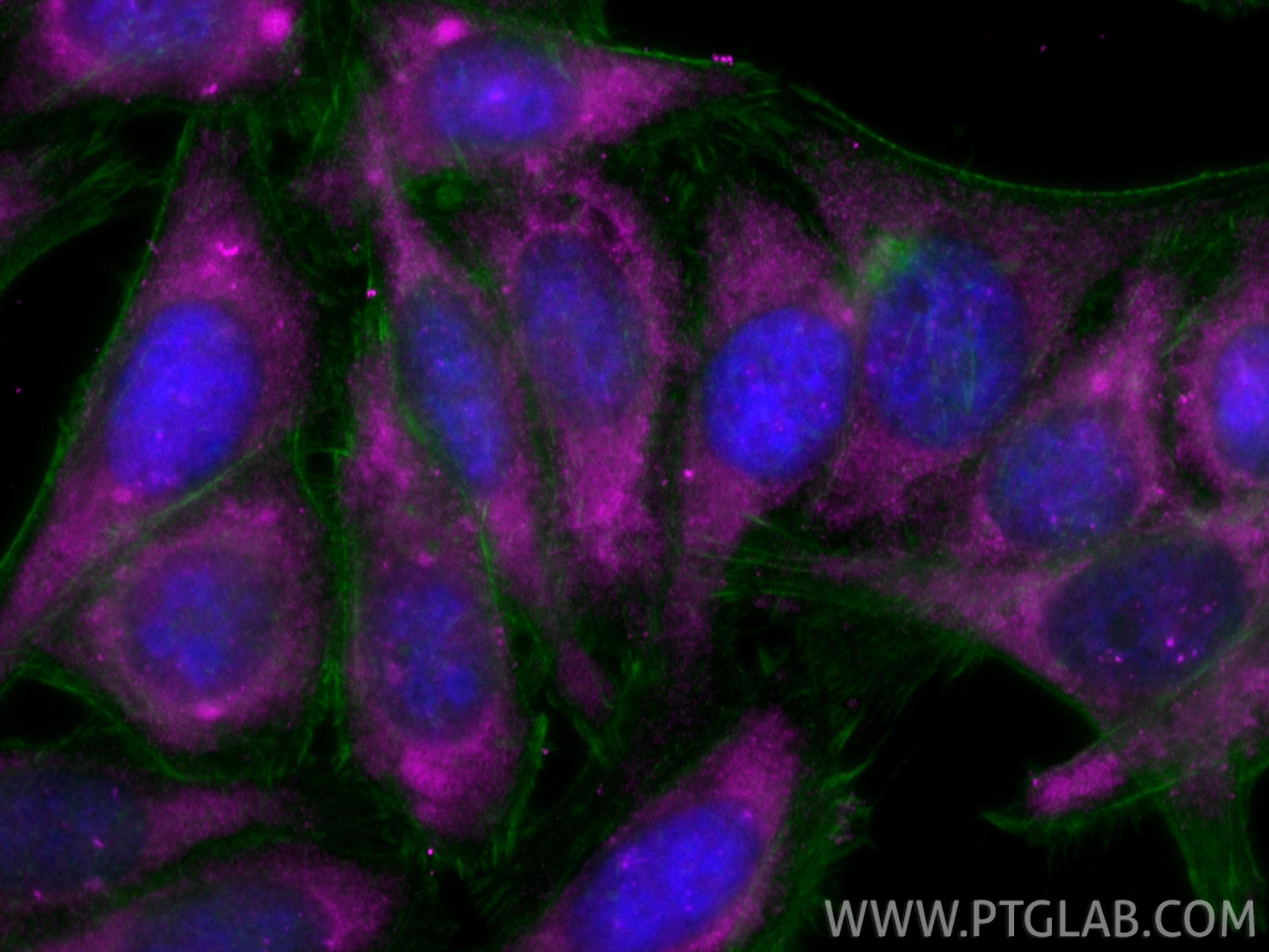 IF Staining of HepG2 using CL647-18254 IF Staining of HepG2 using CL647-18254