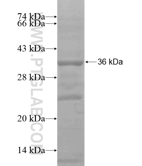 APOE fusion protein Ag19290 SDS-PAGE APOE fusion protein Ag19290 SDS-PAGE