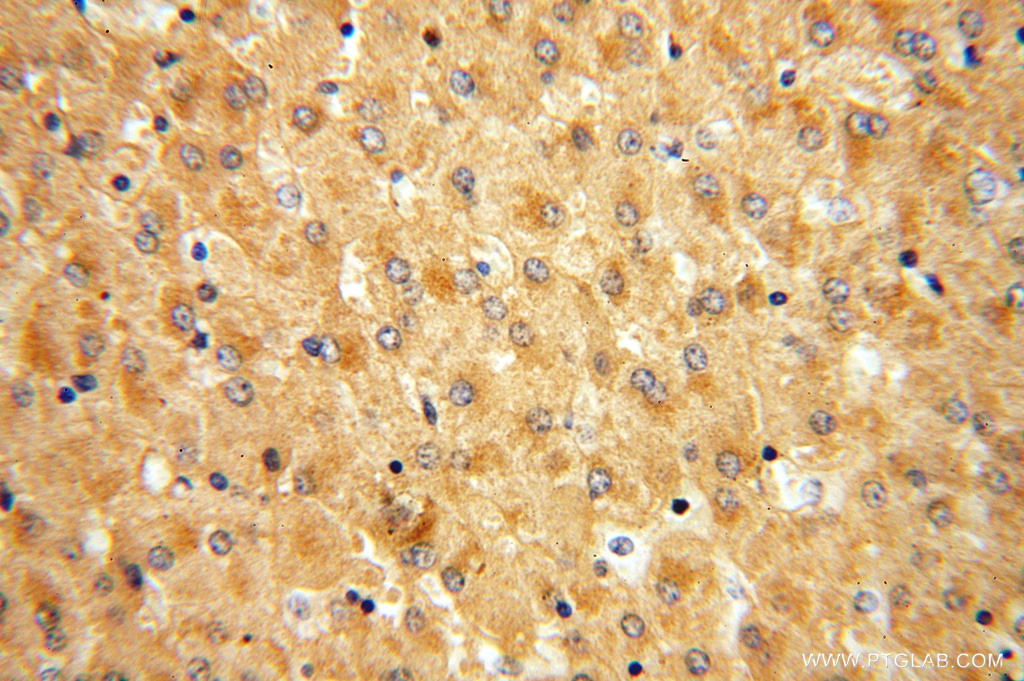 IHC staining of human liver using 16608-1-AP