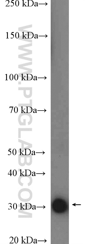 WB analysis of human plasma using 16608-1-AP