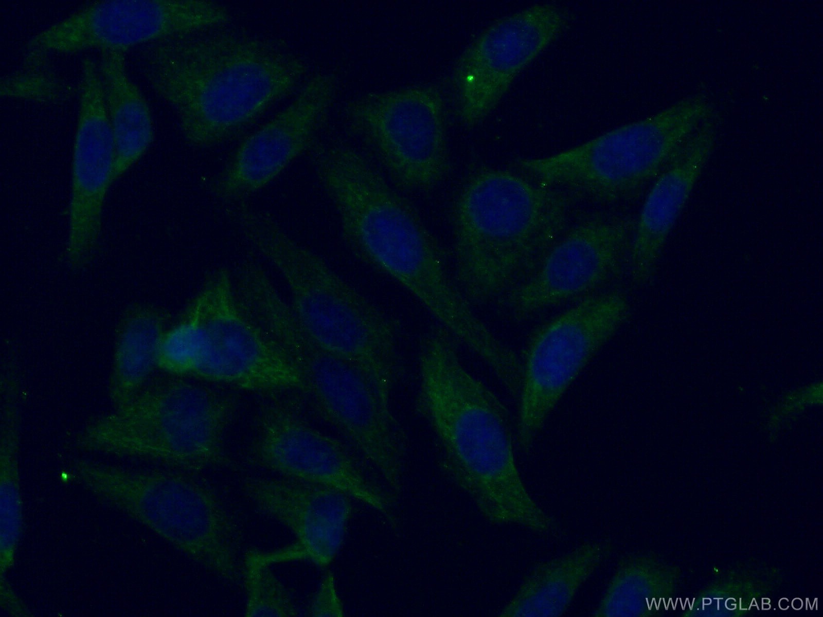 IF Staining of HepG2 using 11892-1-AP