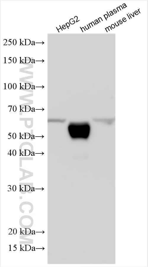 WB analysis using 11892-1-AP