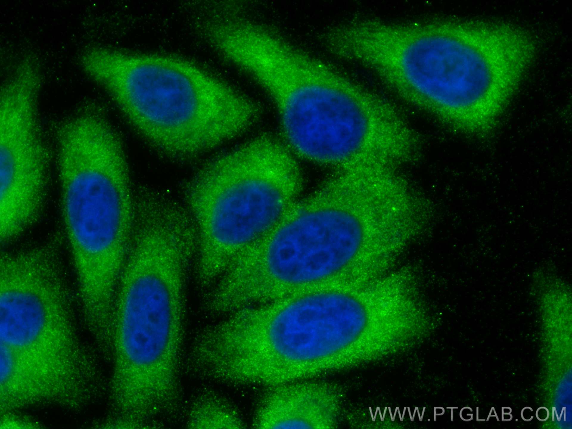 IF Staining of HepG2 using 66074-1-Ig (same clone as 66074-1-PBS)