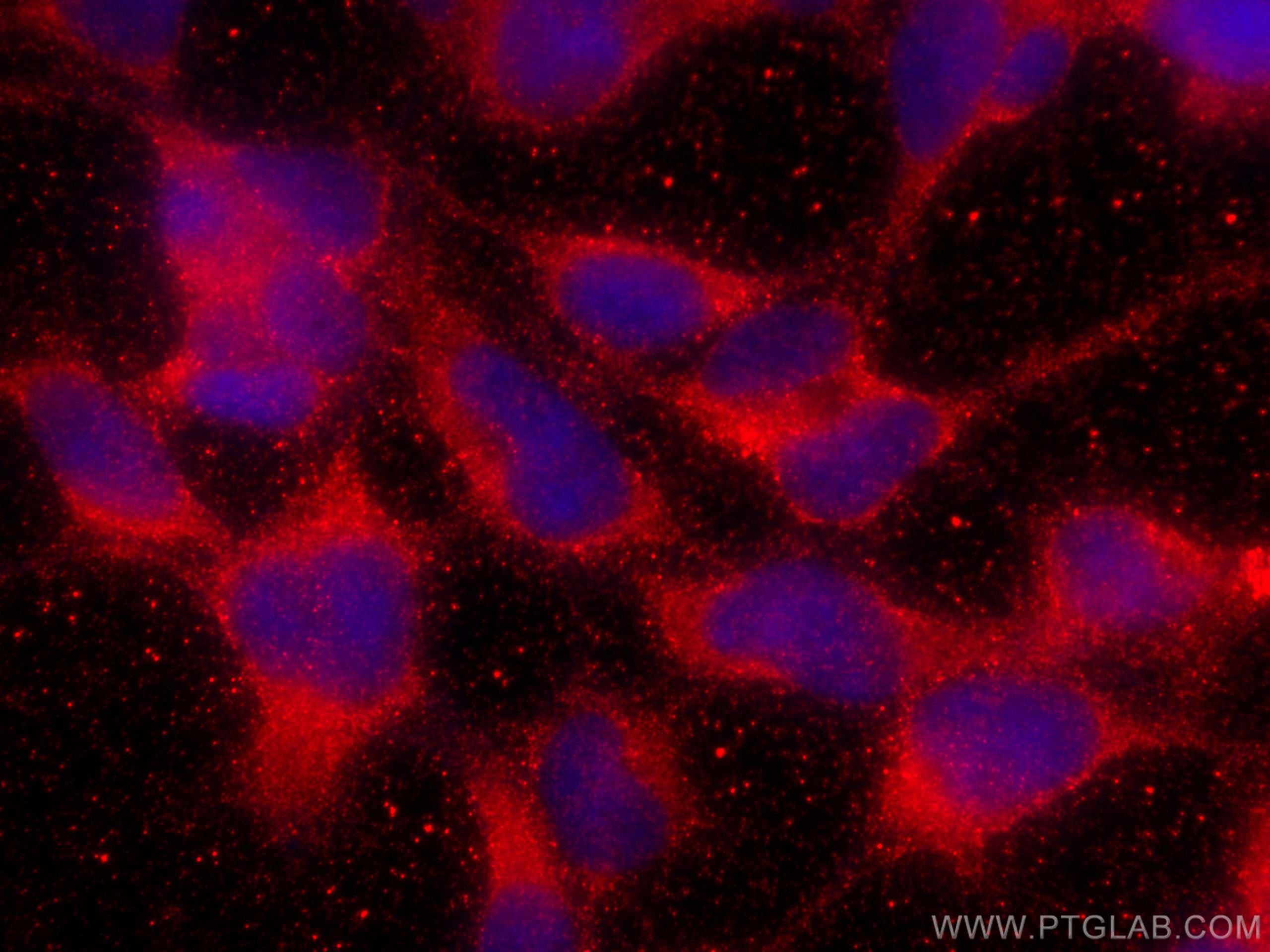 IF Staining of HEK-293 using 11486-2-AP