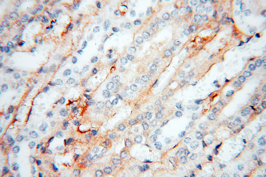 IHC staining of human kidney using 11486-2-AP