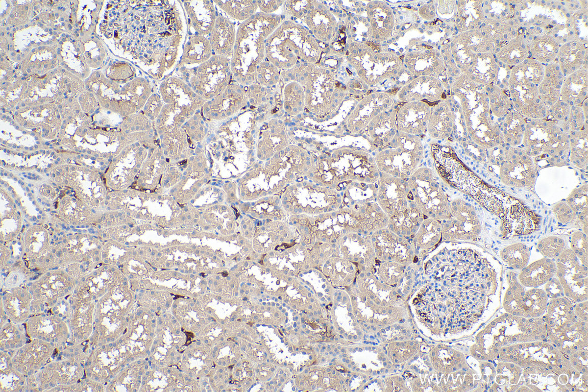 IHC staining of human kidney using 66124-1-Ig