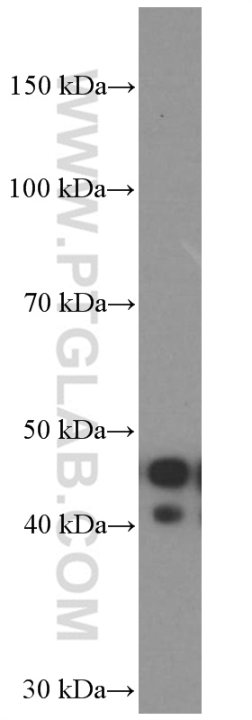 APOL1-Specific Monoclonal antibody