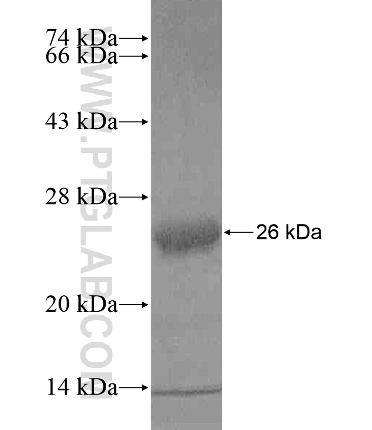 APOL1 fusion protein Ag17953 SDS-PAGE APOL1 fusion protein Ag17953 SDS-PAGE