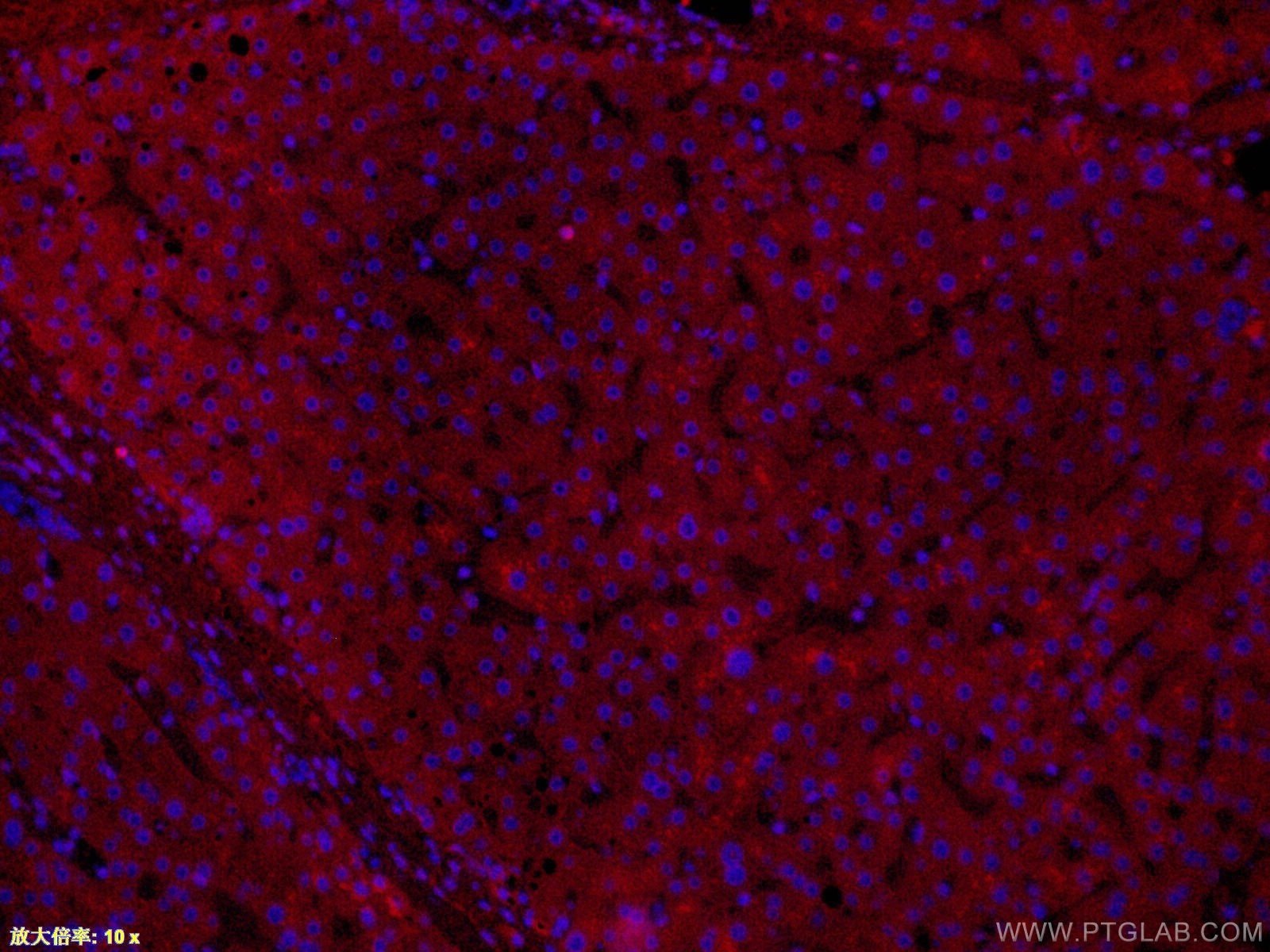 IF Staining of human liver using CL647-66124