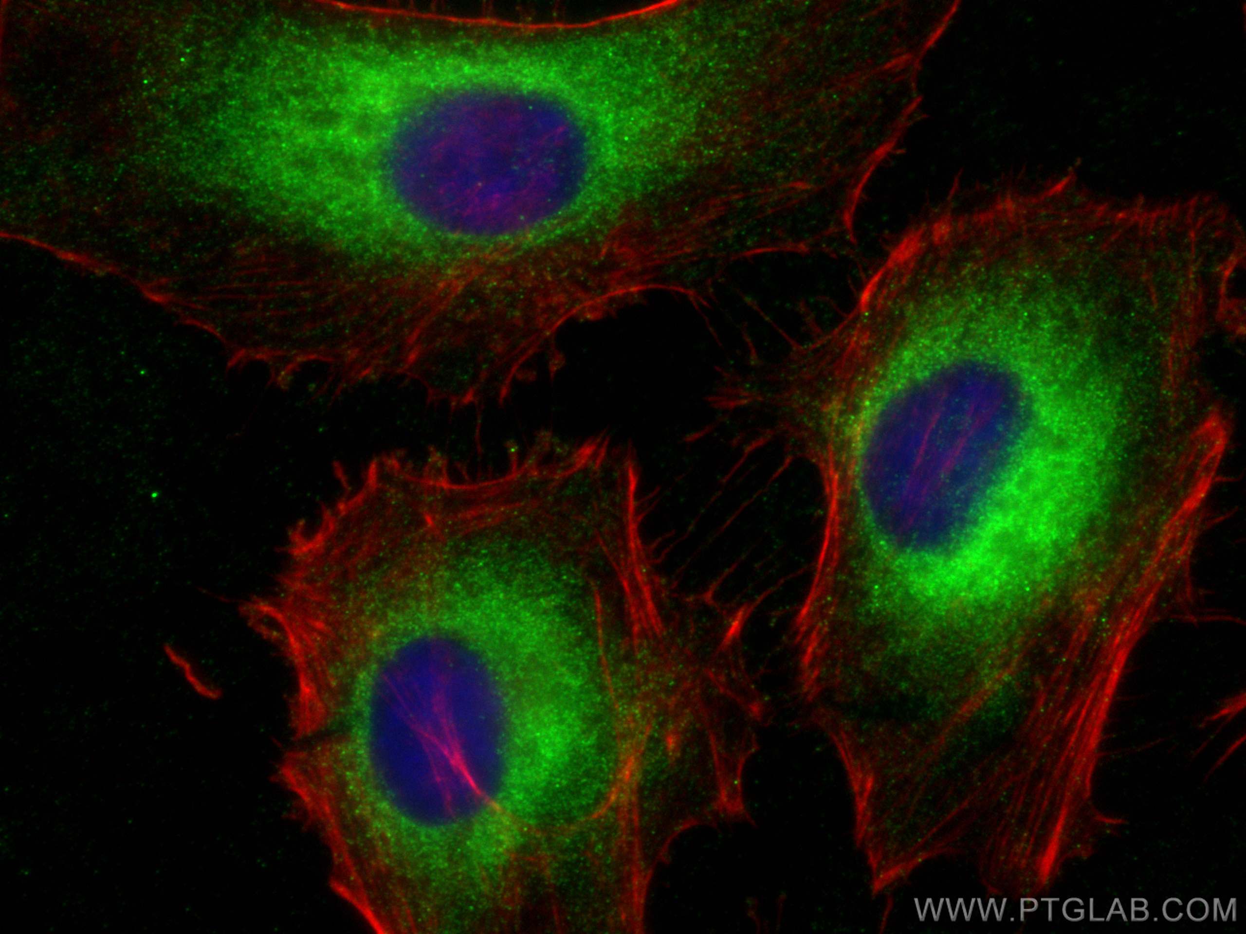 IF Staining of HeLa using 25925-1-AP