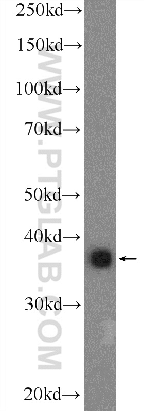 WB analysis of A549 using 25925-1-AP