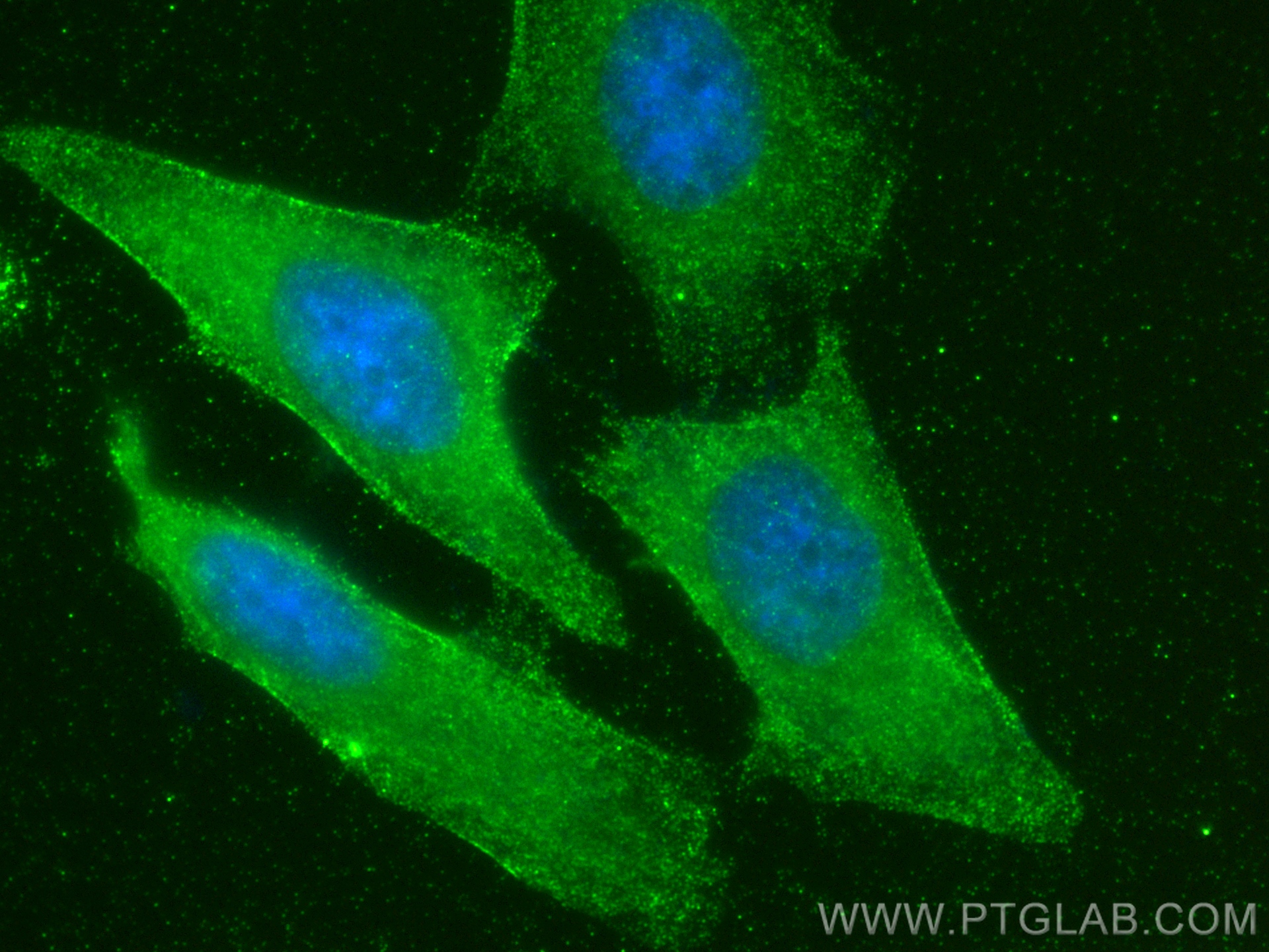 IF Staining of HeLa using 82877-2-RR (same clone as 82877-2-PBS)
