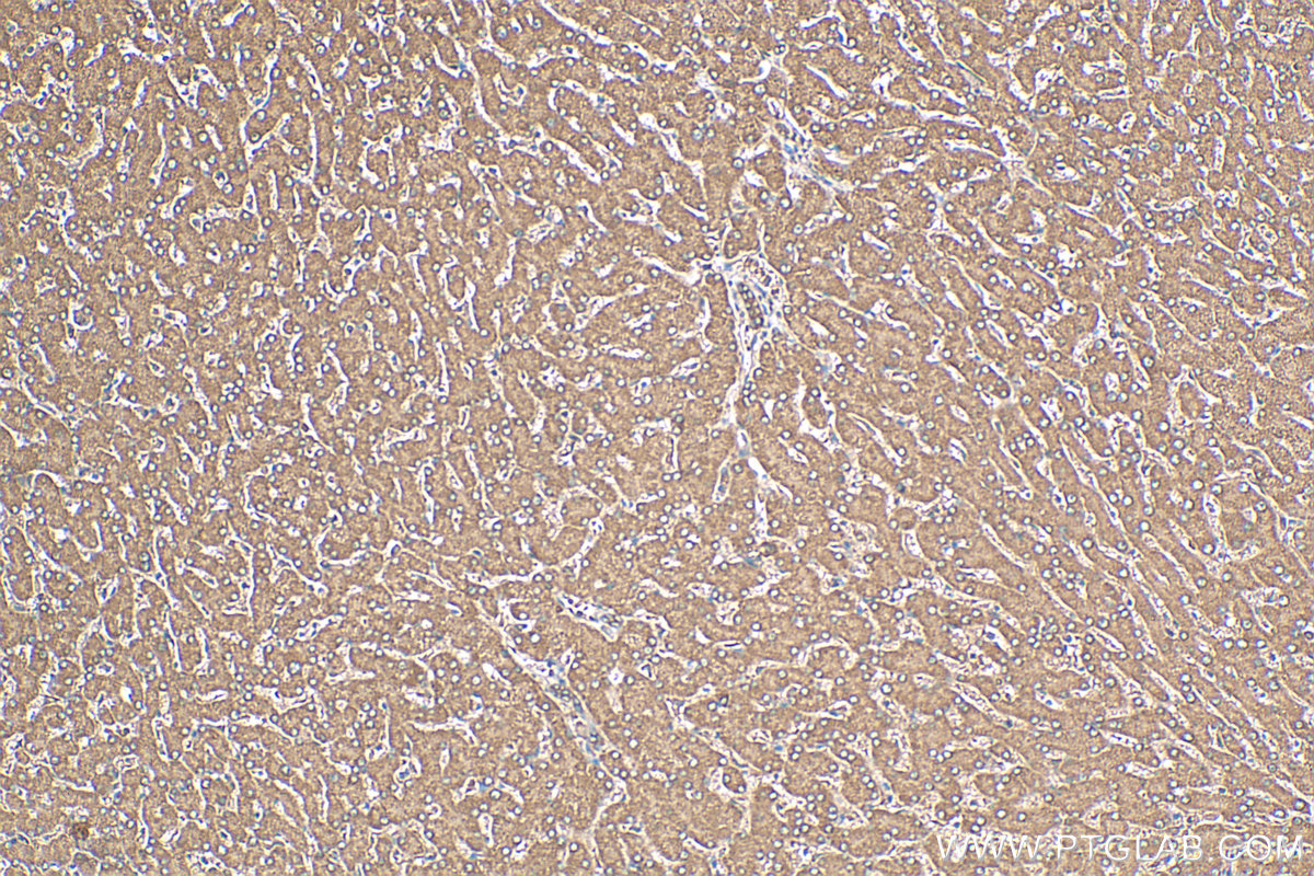 IHC staining of human liver using 12817-1-AP