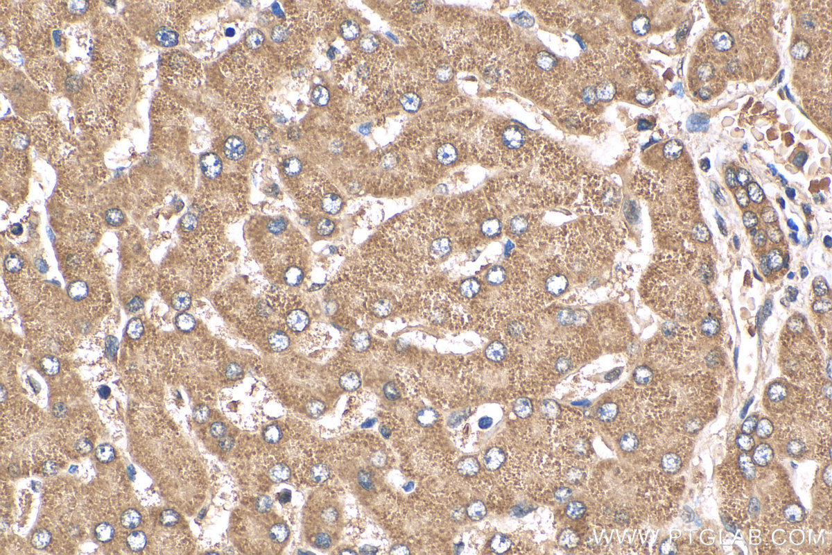 IHC staining of human liver using 12817-1-AP