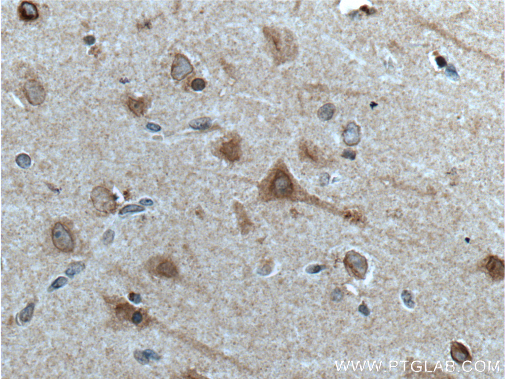 IHC staining of human brain using 10524-1-AP