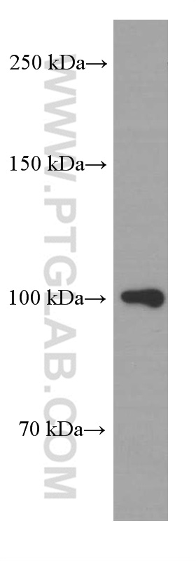 APP Monoclonal antibody