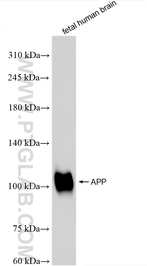 WB analysis of fetal human brain using 84829-6-RR
