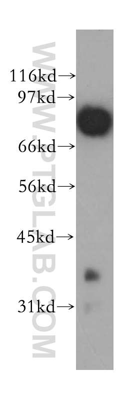 APPL1 Polyclonal antibody