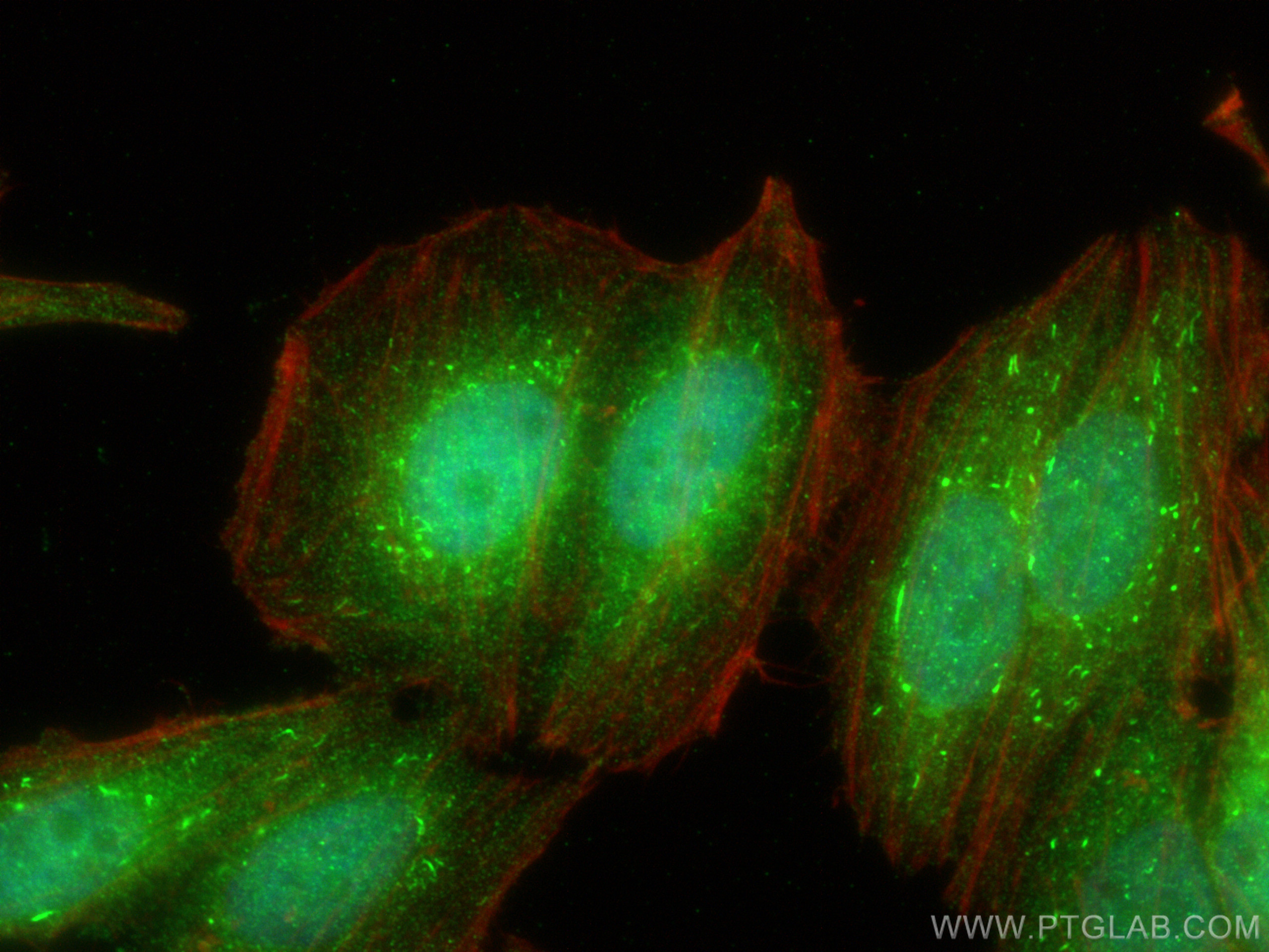 IF Staining of HepG2 using 19885-1-AP