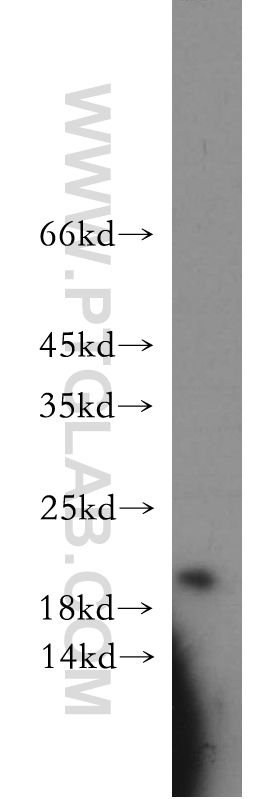 WB analysis of A549 using 21405-1-AP