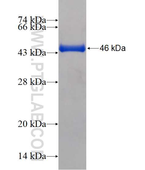 APRT fusion protein Ag16119 SDS-PAGE