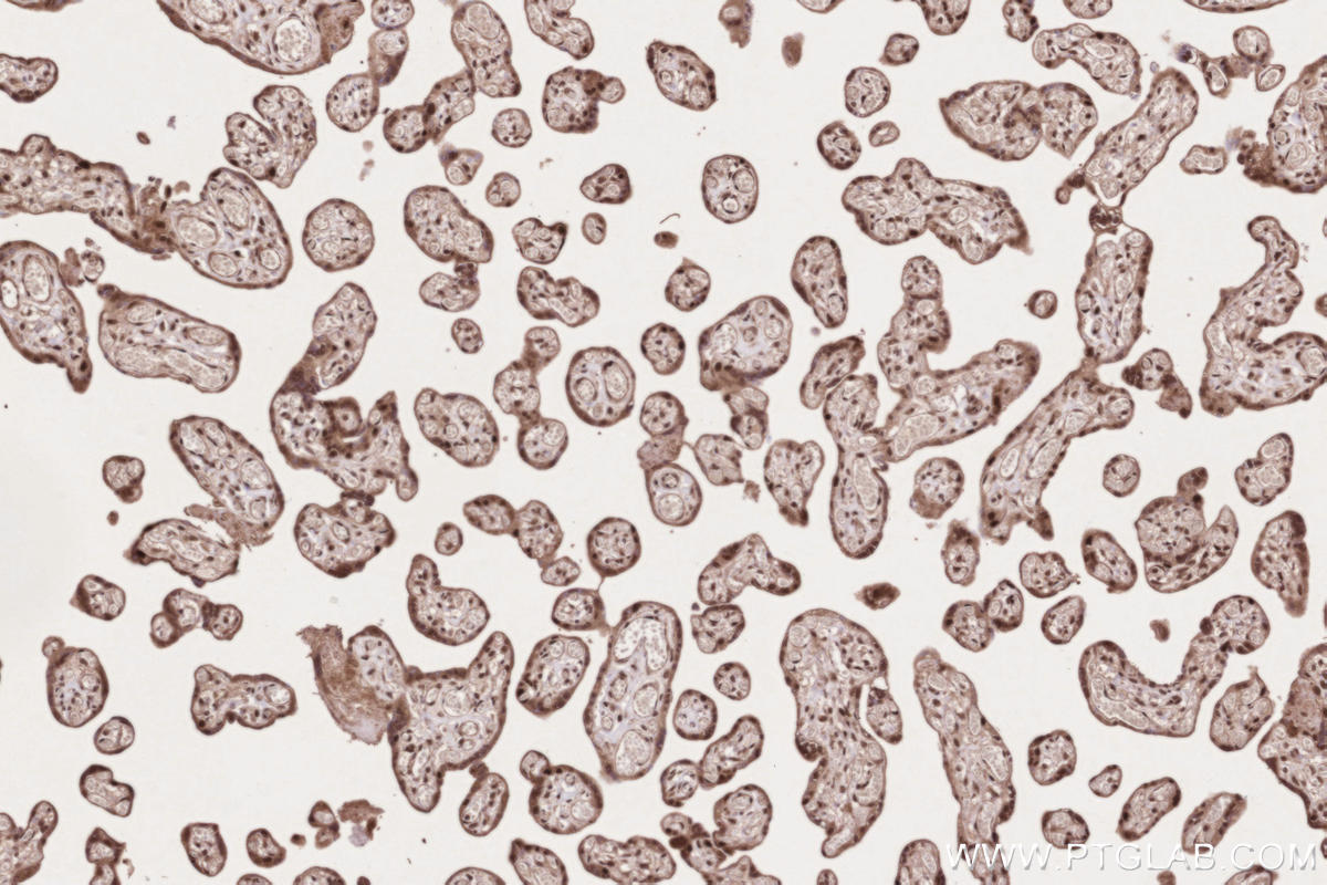 IHC staining of human placenta using 26747-1-AP IHC staining of human placenta using 26747-1-AP