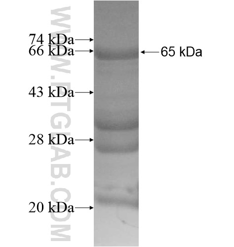 APTX fusion protein Ag13390 SDS-PAGE