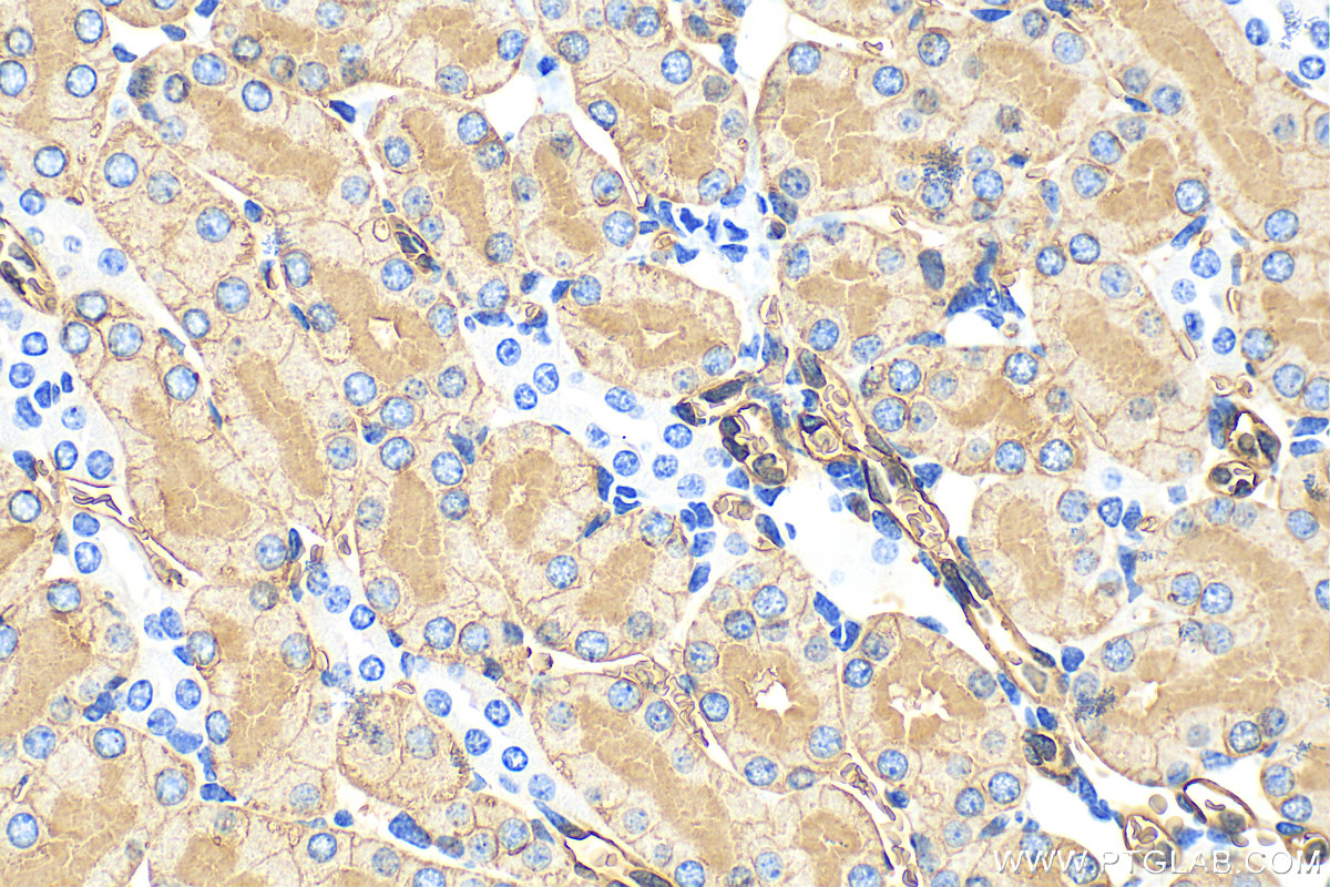 IHC staining of mouse kidney using 20333-1-AP