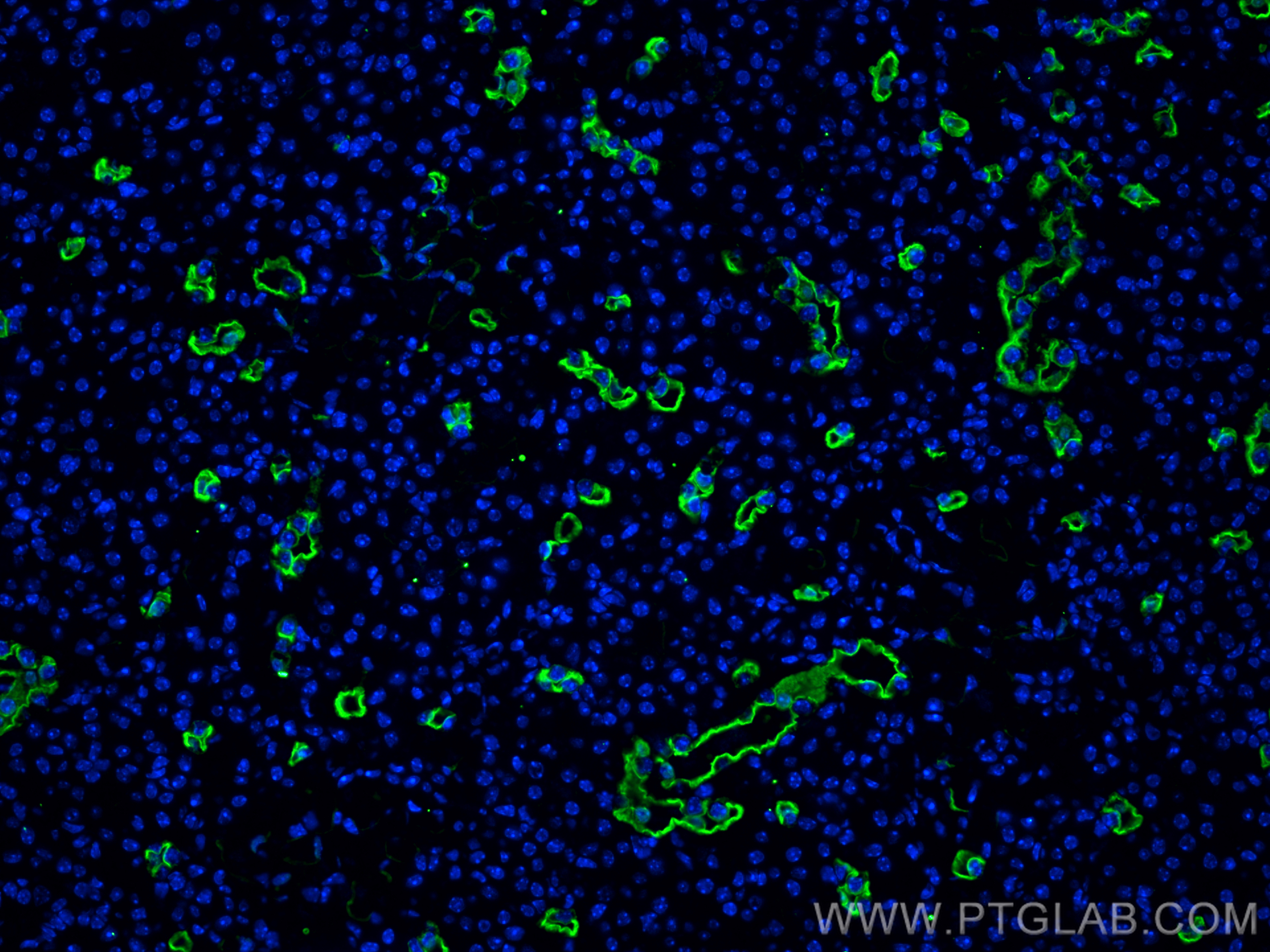 IF Staining of mouse kidney using 66805-1-Ig