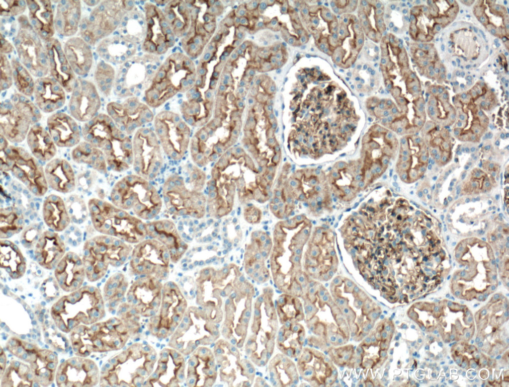 IHC staining of human kidney using 66805-1-Ig