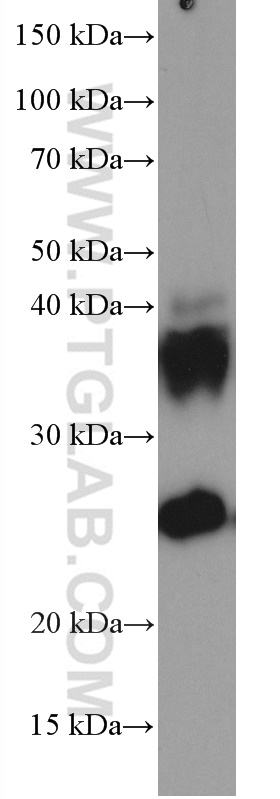 AQP1