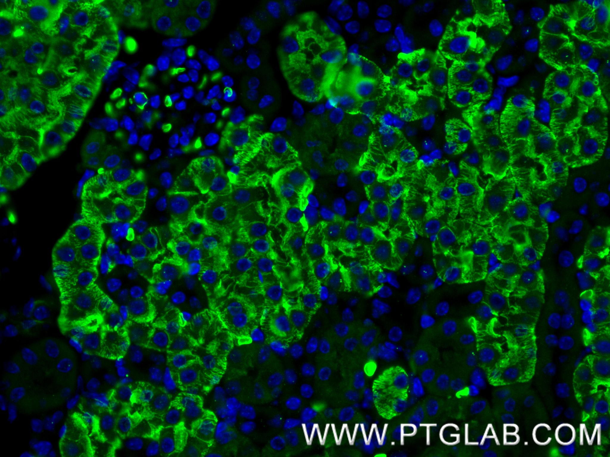 IF Staining of mouse kidney using 81137-2-RR (same clone as 81137-2-PBS) IF Staining of mouse kidney using 81137-2-RR (same clone as 81137-2-PBS)