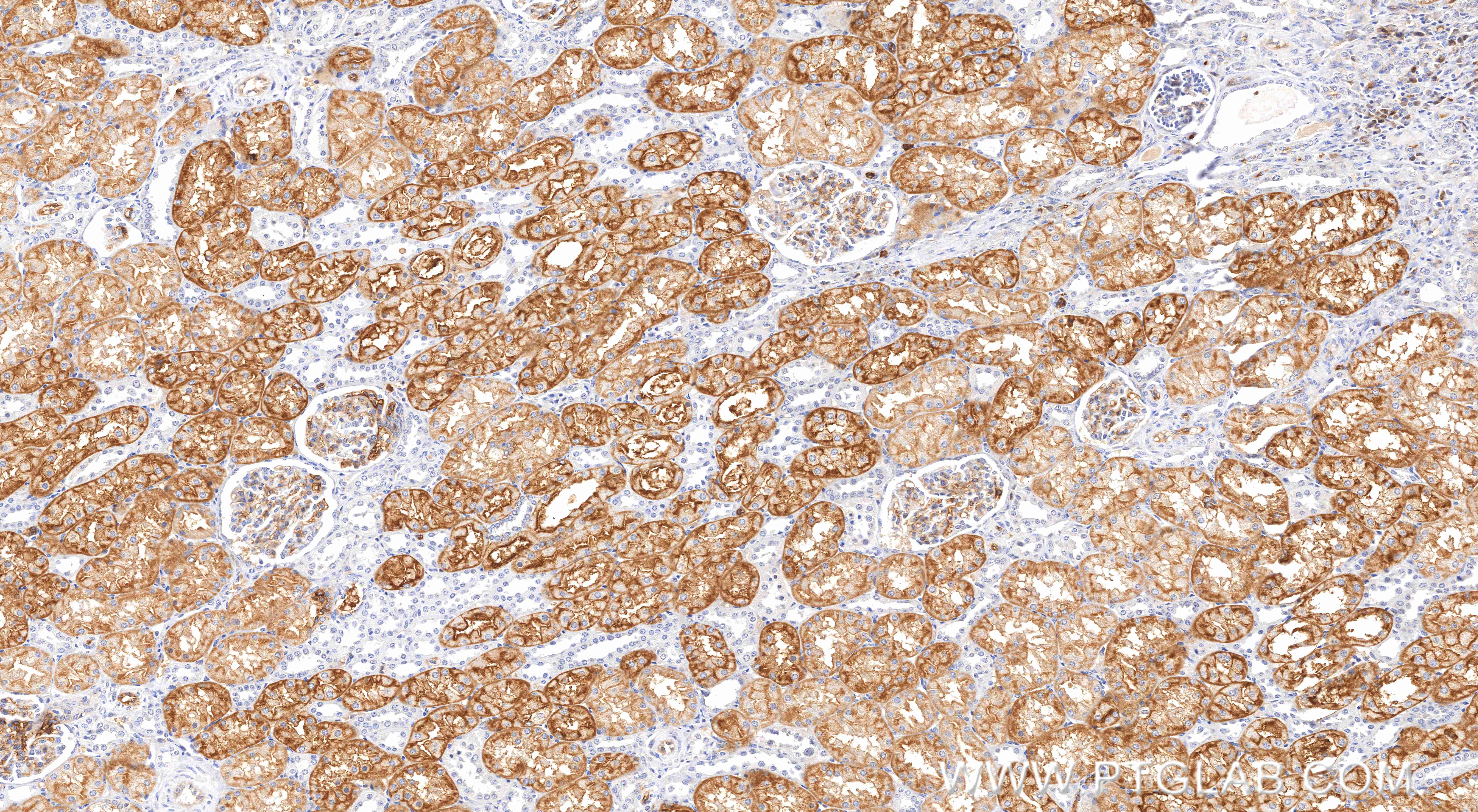 IHC staining of human kidney using 81137-2-RR (same clone as 81137-2-PBS) IHC staining of human kidney using 81137-2-RR (same clone as 81137-2-PBS)