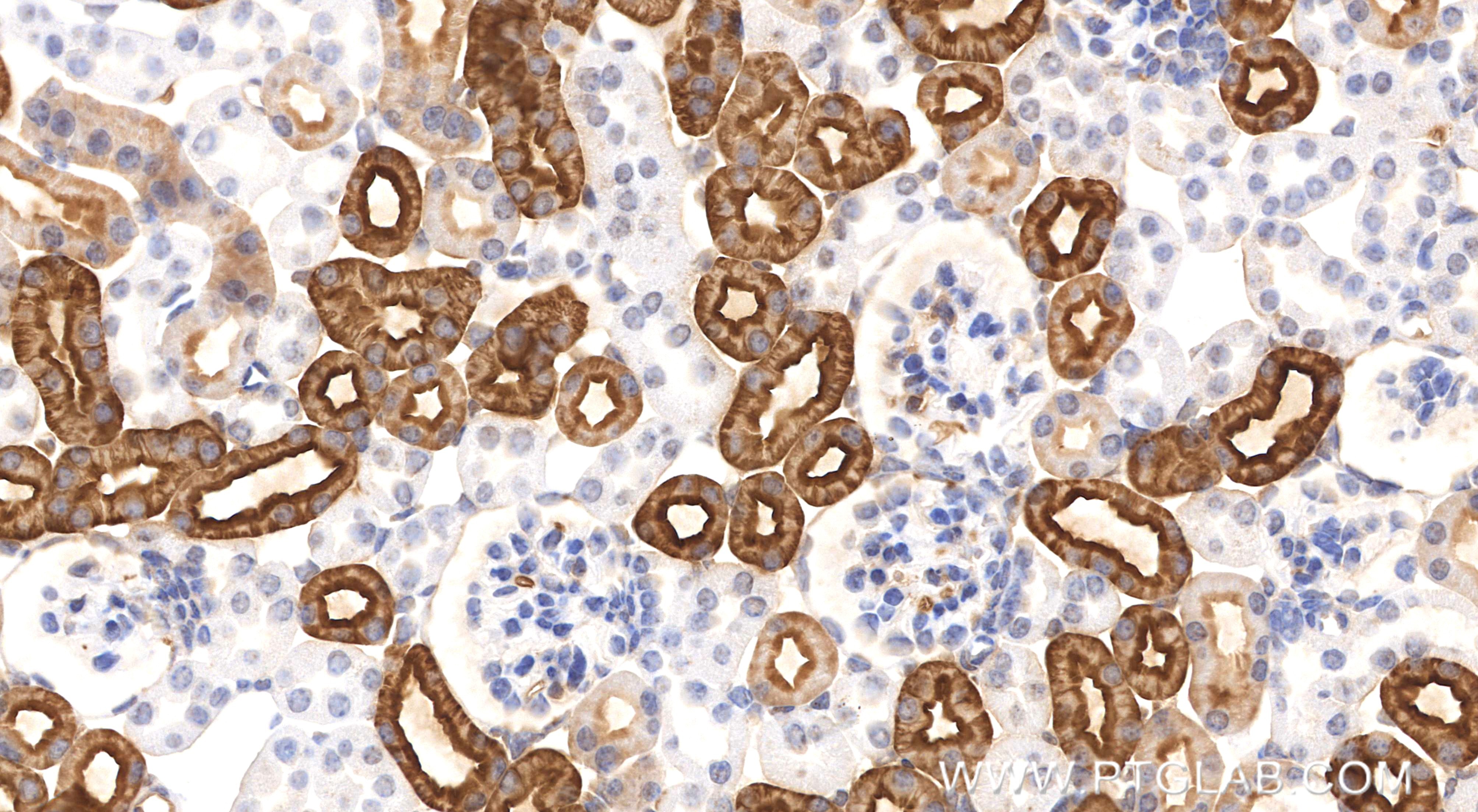 IHC staining of mouse kidney using 81137-2-RR (same clone as 81137-2-PBS) IHC staining of mouse kidney using 81137-2-RR (same clone as 81137-2-PBS)
