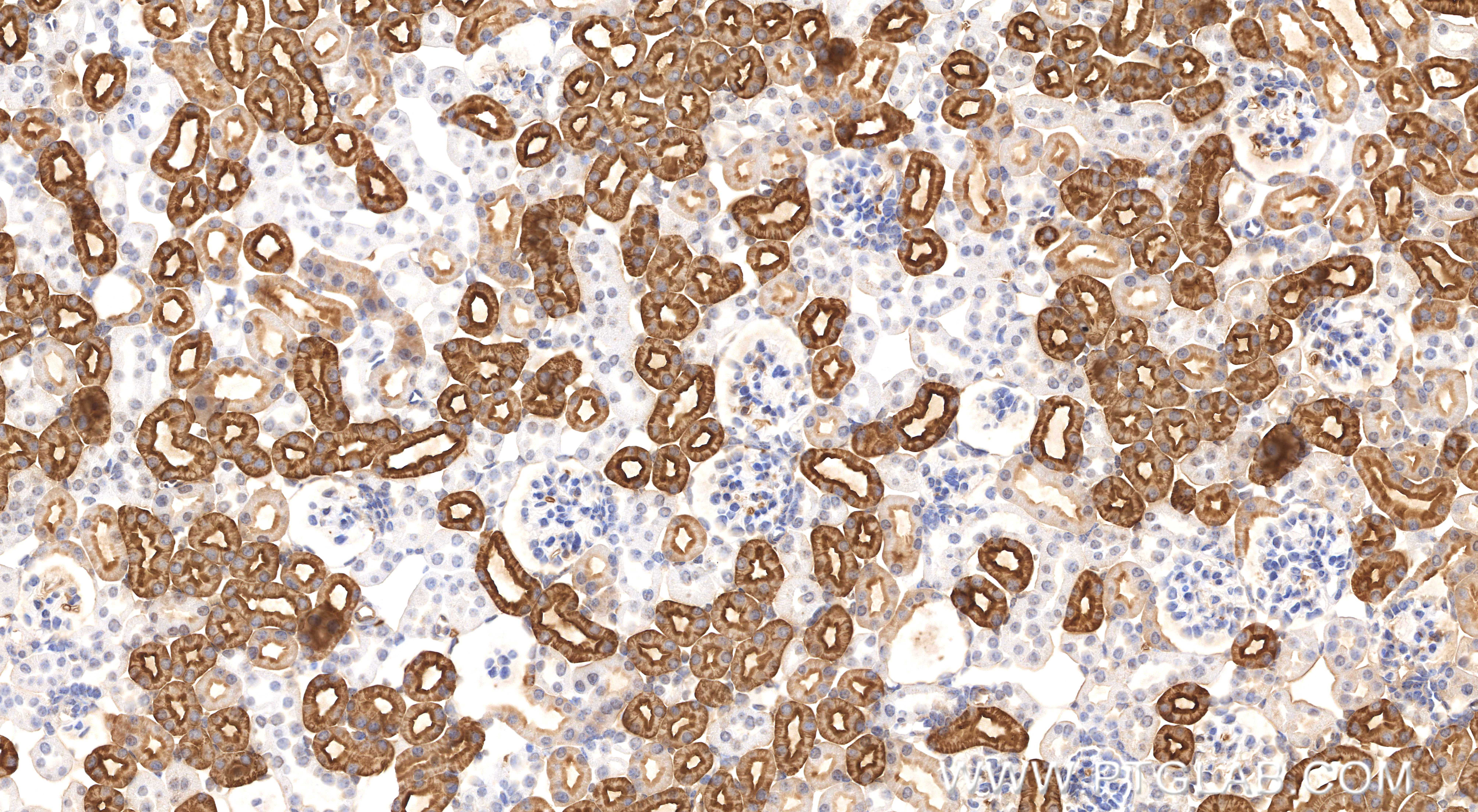 IHC staining of mouse kidney using 81137-2-RR (same clone as 81137-2-PBS) IHC staining of mouse kidney using 81137-2-RR (same clone as 81137-2-PBS)