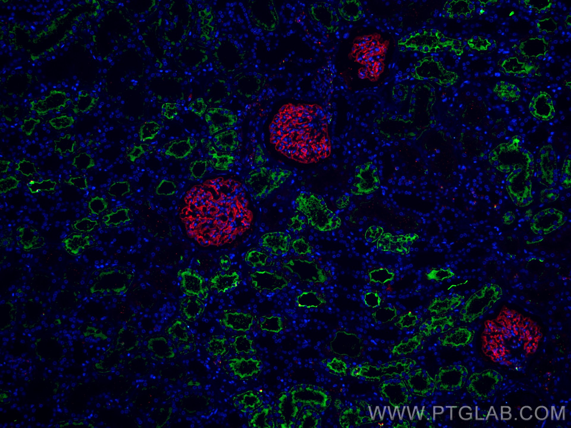 IF Staining of human kidney using CL488-66805