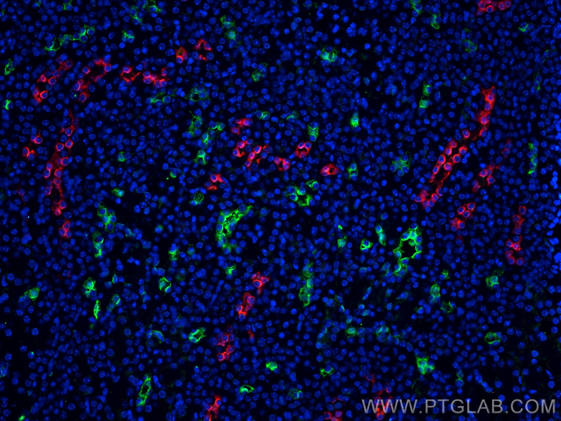 IF Staining of mouse kidney using 29386-1-AP