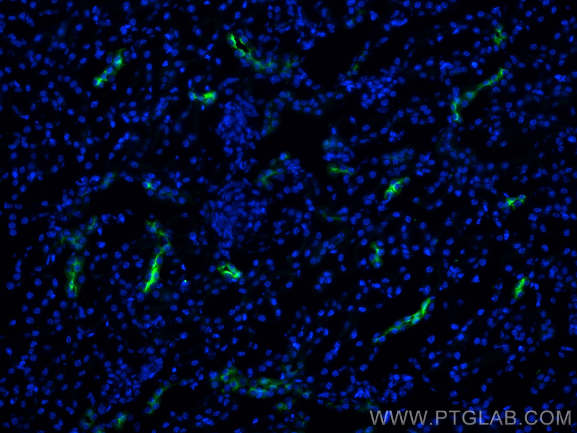 IF Staining of mouse kidney using 29386-1-AP